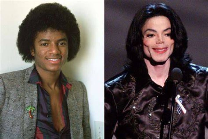 michael-jackson-after.jpg