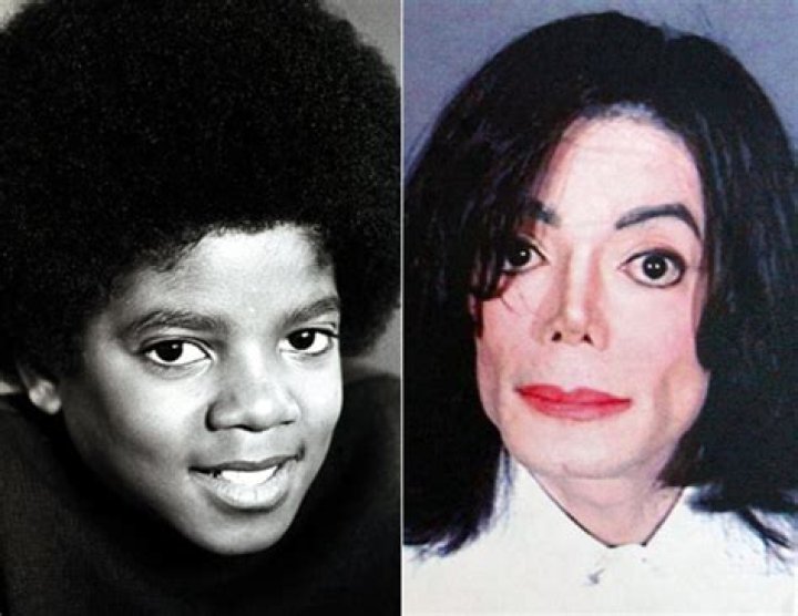 michael-jackson-before.jpg