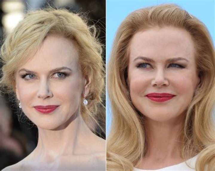 nicole-kidman-after.jpg