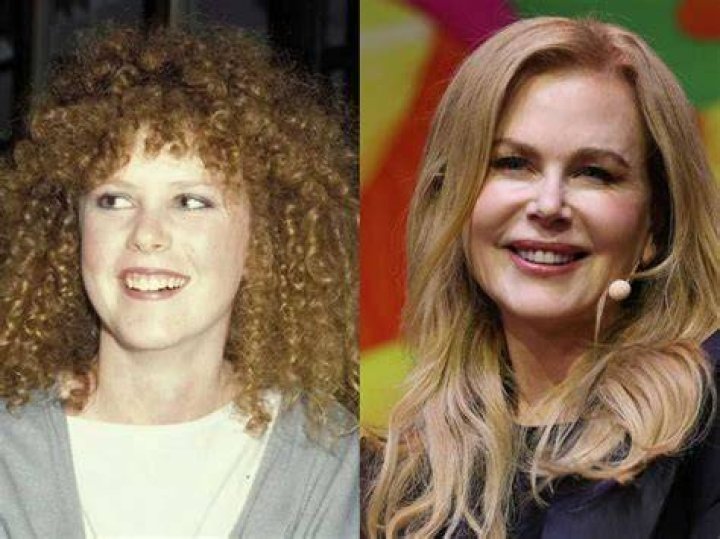 nicole-kidman-before.jpg